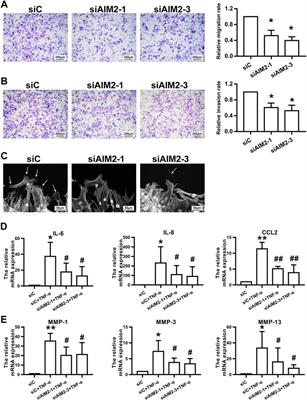 Myricitrin inhibits fibroblast-like synoviocyte-mediated rheumatoid synovial inflammation and joint destruction by targeting AIM2